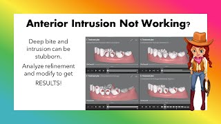 Invisalign ClinCheck  Anterior Intrusion Refinement additional aligners [upl. by Iglesias]