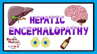 Hepatic Encephalopathy  Pathophysiology Stages and West Haven Criteria [upl. by Bolton]