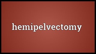 Hemipelvectomy Meaning [upl. by Ehav]