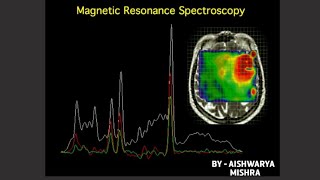 MRS Magnetic Resonance Spectroscopy BY RADIATION TECHNOLOGY [upl. by Dranek]