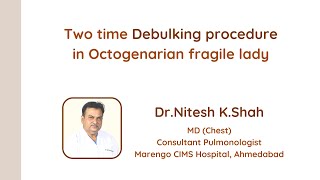 Debulking procedure  Dr Nitesh Shah [upl. by Gildas]