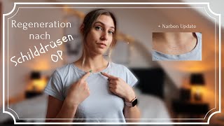 Update nach Schilddrüsen OP ⎢Regeneration ⎢OP Narbe ⎢Tipps nach der OP ⎢Erfahrungsbericht 🏥 [upl. by Mercedes]