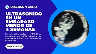 Ultrasonido En Un Embarazo Menor de 4 SemanasDR EDSON CANO [upl. by Schlicher]