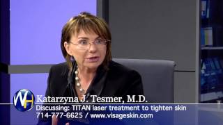 TITAN® laser skin tightening with Anaheim doctor Katarzyna Tesmer MD [upl. by Anitsihc833]