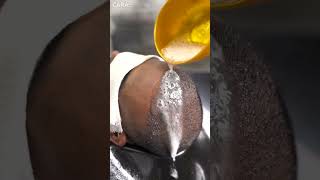 Expert Tips for First Shampoo After Hair Transplant  Cara Clinic [upl. by Fransisco]