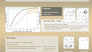 Surveillance du glaucome  Champ Visuel May F [upl. by Noived]