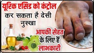 यूरिक एसिड का रामबाण घरेलु इलाज  How to Cure Uric Acid Home Remedy  सरल घरेलू उपचार [upl. by Thielen]