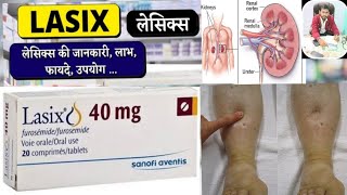 Lasix 40 mg tablet uses in hindi  Lasix Tablet  Furosemide 40 mg [upl. by Gypsy]