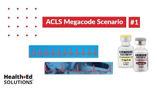 ACLS Megacode Scenario 1 Supraventricular Tachycardia SVT [upl. by Lansing]