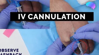 Intravenous IV cannulation  OSCE Guide  UKMLA  CPSA [upl. by Leciram]