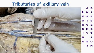 Dissection of axilla and tributaries of axillary vein  Dissection of upper limb  Dr SAM [upl. by Copeland918]