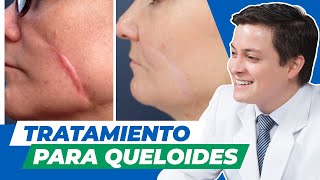 Tratamiento para cicatrices queloides  Clínica Vásquez Lapel [upl. by Nanda]