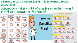 CBC SE GBP या PBS GENERAL BLOOD PICTURE or PERIPHERAL BLOOD SMEAR KI REPORT KAISE BANAYE [upl. by Ahsienom]