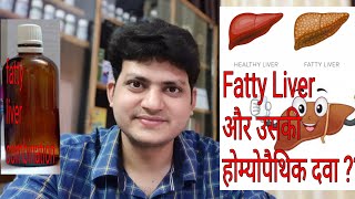 Fatty liver  Homeopathic Medicine for Fatty liver  My Combination [upl. by Llenrub173]