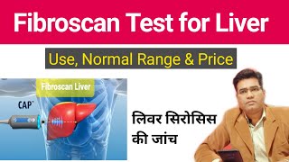 What is Fibroscan Test for Liver  Explained in Hindi  Use Price and Normal Range [upl. by Ynogoham970]