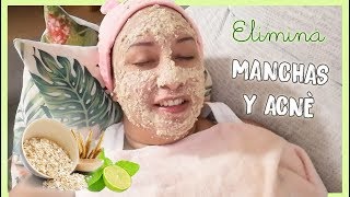 MASCARILLA DE AVENA Y LIMON  Aclara y elimina el acnè en tu rostro [upl. by Acnaiv359]