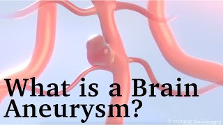 Brain Aneurysm Awareness Month  What are the Signs of a Ruptured Brain Aneurysm [upl. by Adnoluy]