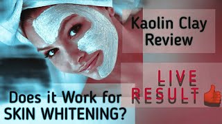 Magical Face Mask Kaolin Clay Review [upl. by Aitnauq]