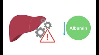 Getting to know albumin physiology [upl. by Ahsienahs569]