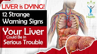 LIVER is DYING  12 Strange Warning Signs Your Liver Could Be in Serious Trouble  LifeHealth [upl. by Hannah]