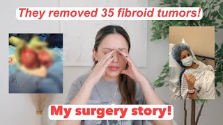 My Crazy Uterine Fibroid Surgery  Story Time  Massive Fibroid Tumors Journey  Myomectomy Postop [upl. by Moreno]