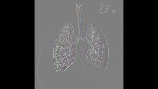 Pneumothorax Animation variation 6 shorts medical [upl. by Enyluqcaj]