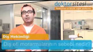 protez sonrası dişeti morarması [upl. by Marston]