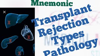 Pathology of all Transplant Rejection Types Mnemonic [upl. by Philender]