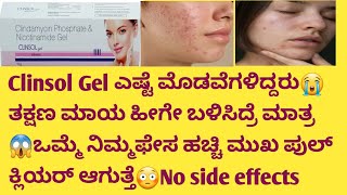 Clinsol Gel👌😍ಎಷ್ಟೆ ಮೊಡವೆಗಳಿದ್ದರು😭 ತಕ್ಷಣ ಮಾಯ😱ಒಮ್ಮೆ ನಿಮ್ಮಫೇಸ ಹಚ್ಚಿ ಮುಖ ಪುಲ್ ಕ್ಲಿಯರ್ ಆಗುತ್ತೆ😳 [upl. by Nyleve790]