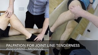 Palpation For Joint Line Tenderness At The Knee Joint [upl. by Atiseret]