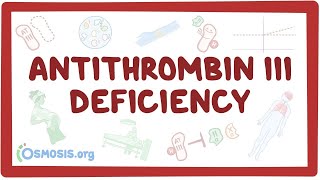 Antithrombin Deficiency Symptoms and Causes  Diagnosis  Treatment  Prevention [upl. by Skye]