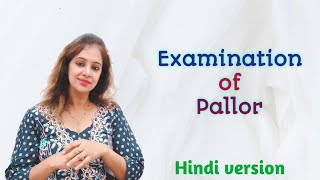 Examination of Pallor In Hindi [upl. by Eirb336]