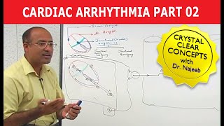 Cardiac Arrhythmia  Part 23 [upl. by Herman]