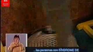 Síndrome de Prader Willi UNED TV 1999 13 [upl. by Tsan]