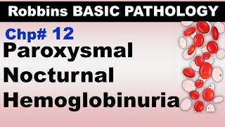 Ch12  Paroxysmal Nocturnal Hemoglobinuria  Blood Pathology  Dr Asif Lectures [upl. by Nnylf]