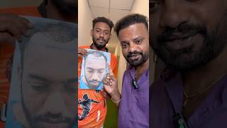 4 Month Amazing Hair Transplant Results  Tamil Hair Transplant  Sukira Aesthetic  Coimbatore [upl. by Adnyleb]