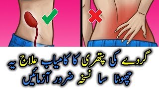 gurdy main pathri ka ilaj  kidney stone treatment urduhindi  Health Ki Dunya [upl. by Eanaj]