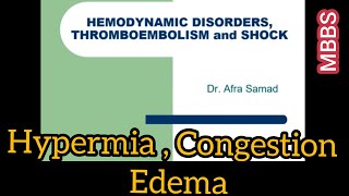 HEMODYNAMIC DISORDERS THROMBOEMBOLISM and SHOCK  G pathology  Hypermia Congestion amp Edema [upl. by Lisette]