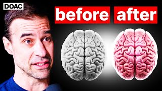 The BEST Type of Exercise To HEAL Your BRAIN  The Brain Professor [upl. by Ebag]