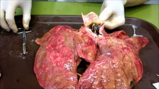 HD吸煙豬肺 Smoking pig lungs show what smoking REALLY does [upl. by Oruam]