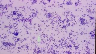 Cytology microscopy [upl. by Ruthi]