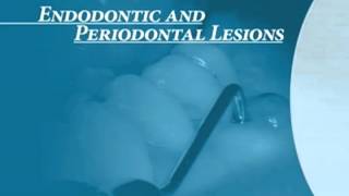 Endodontics Torabinejad 60 Endo Perio Introduction [upl. by Leund884]