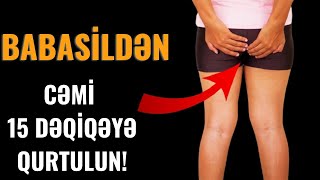 Babasili olanlar bu video sizin üçündür  Gecikdirmədən baxın [upl. by Egan]