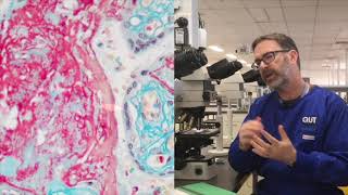 Microscope tutorial  Troubleshooting the MSB stain [upl. by Ardnosac549]