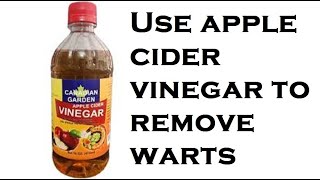 Use apple cider vinegar to remove warts [upl. by Htebarual876]