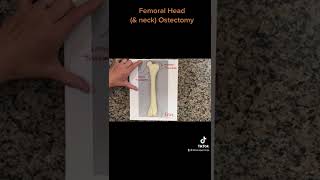 FHO  Femoral Head amp neck Ostectomy [upl. by Noellyn621]