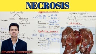 NECROSIS  cell injury  general Pathology Hindi [upl. by Adrian]