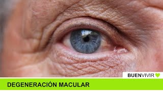 DEGENERACIÓN MACULAR  Consultorio Nítido  BUENVIVIR💚 071024 Canal 4 [upl. by Maharg]