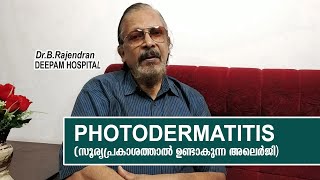 PHOTODERMATITIS  MEDI TALK  DR B RAJENDRAN  DEEPAM HOSPITAL [upl. by Aicinad]