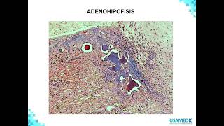 Epitelio endocrino renal reproductor y de los sentidos  Histologia 4  USAMEDIC [upl. by Amend]